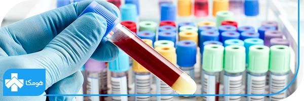 آزمایش در منزل