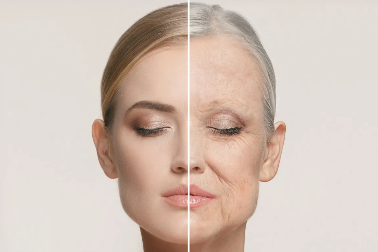 تزریق بوتاکس