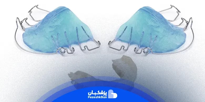 مزایا و معایب ارتودنسی متحرک