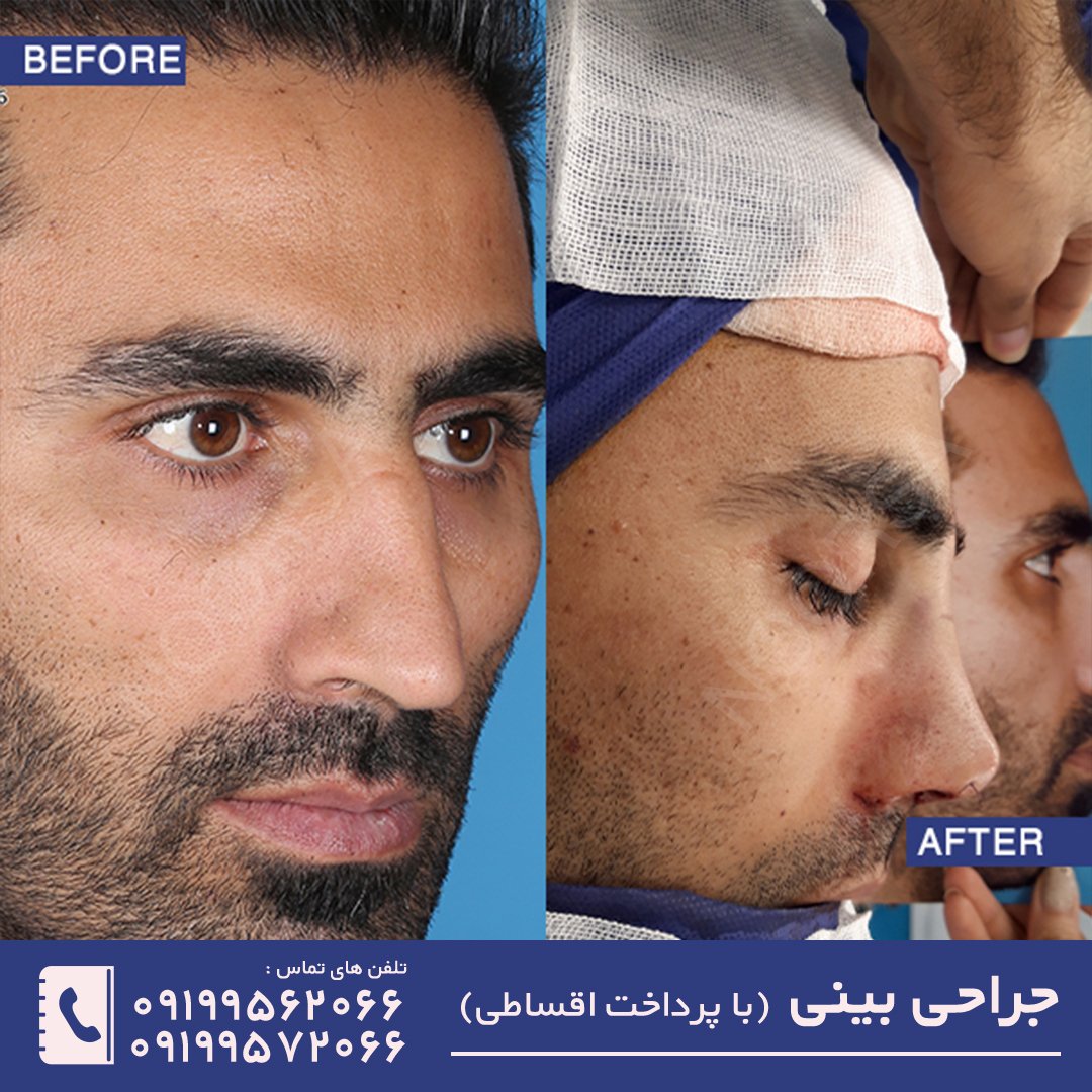 نمونه عمل بینی فانتزی