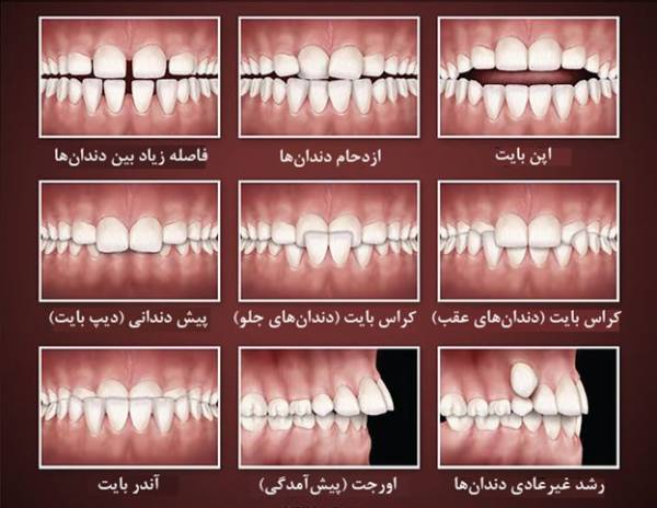 مشکلات ارتودنسی