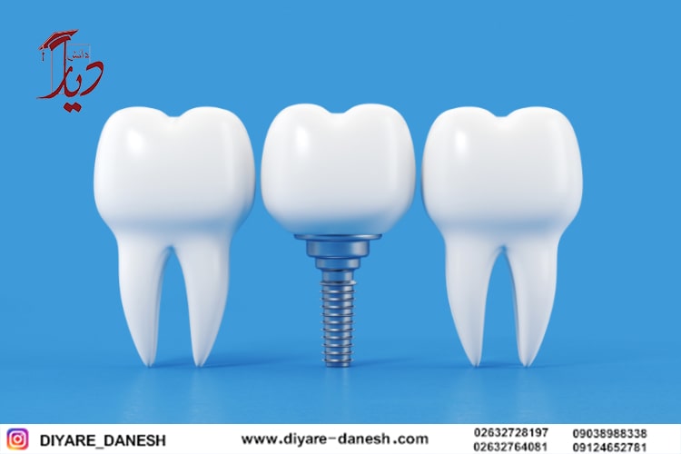 تحصیل دندان پزشکی در کشور ترکیه
