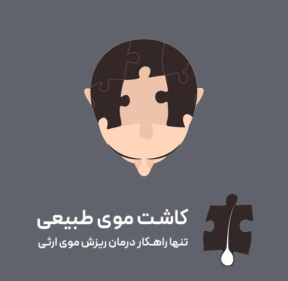 کاشت موی طبیعی