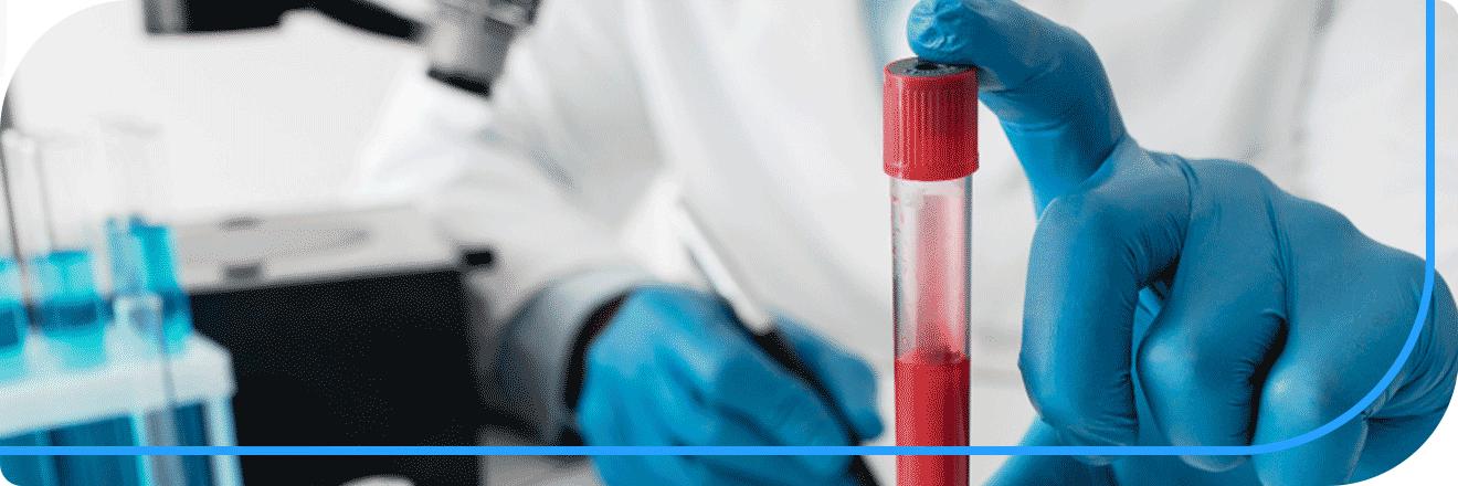 اندازه‌گیری سطح قند خون ناشتا