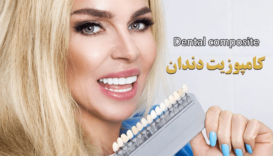 کامپوزیت دندان