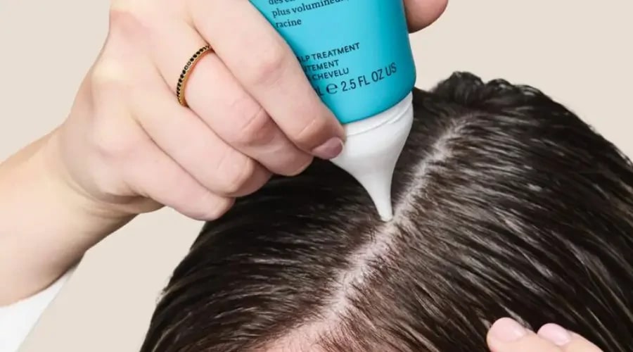 درمان دارویی برای ریزش مو