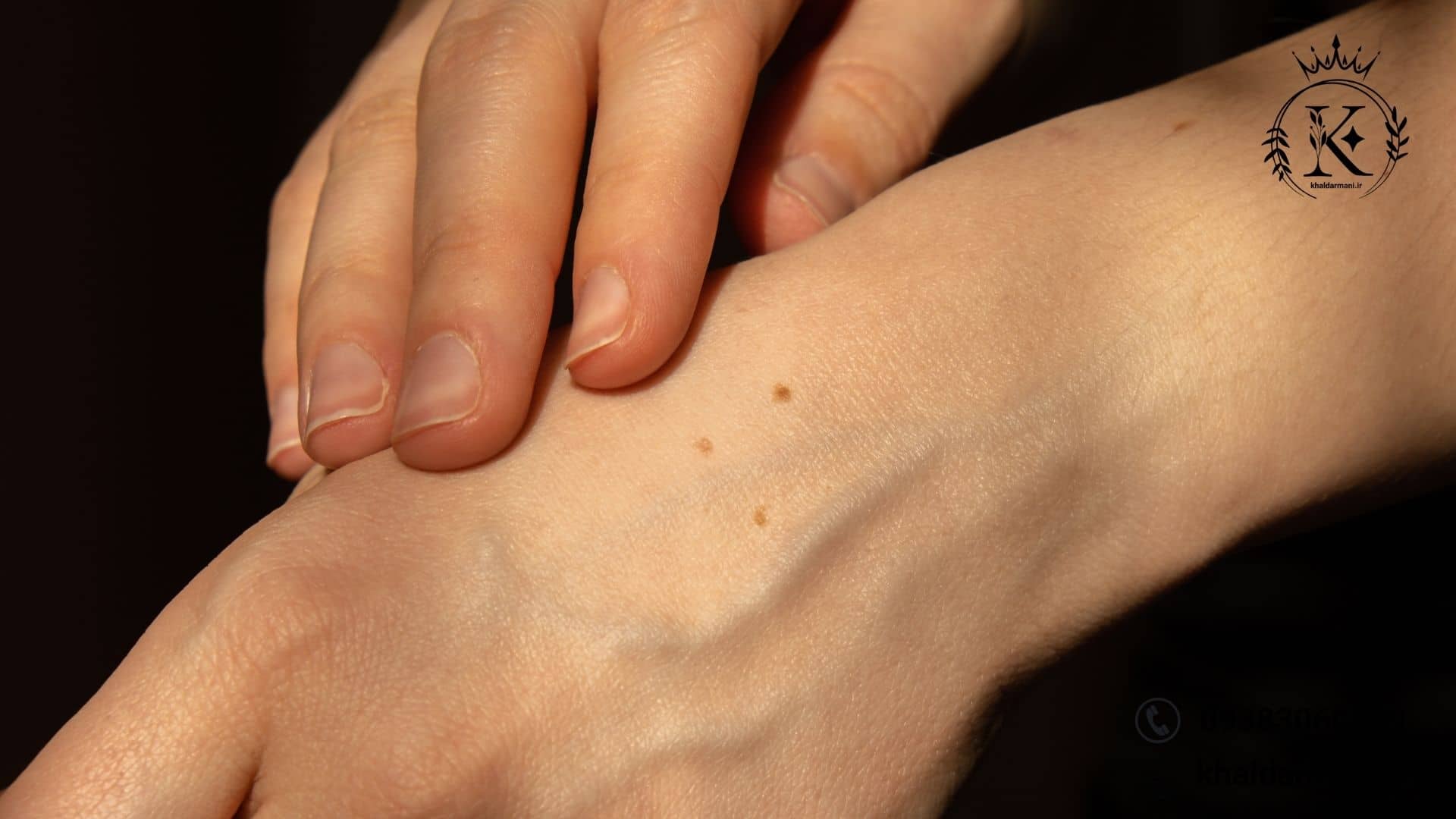 قطره خال بر