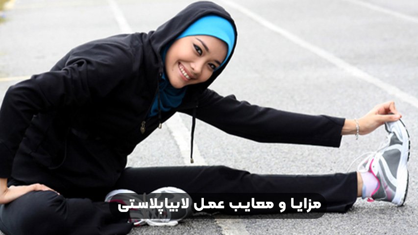 ورزش بعد از لابیاپلاستی