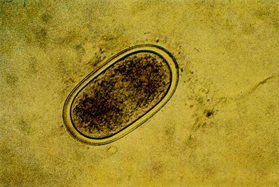 تفسیر آزمایش مدفوع