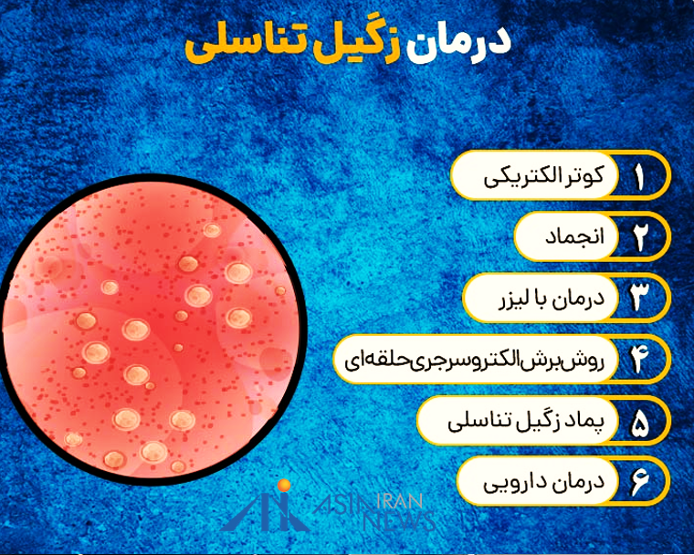 علائم زگیل تناسلی