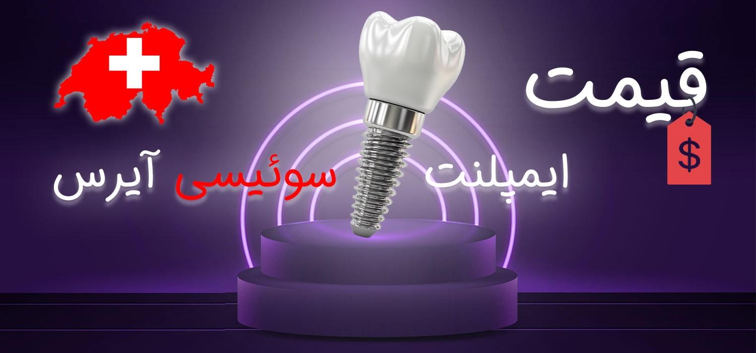 قیمت ایمپلنت سویٔیسی آیرس