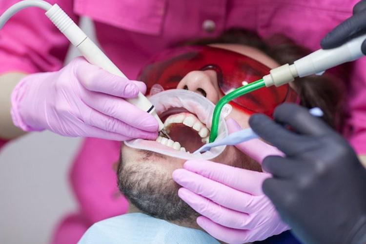 دهان بازکن دندانپزشکی