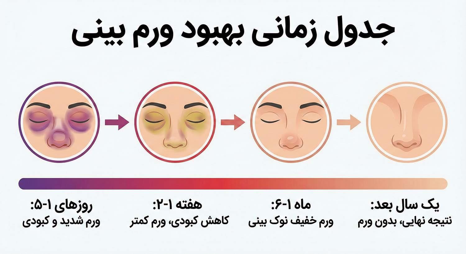 جدول زمانی بهبود ورم بینی
