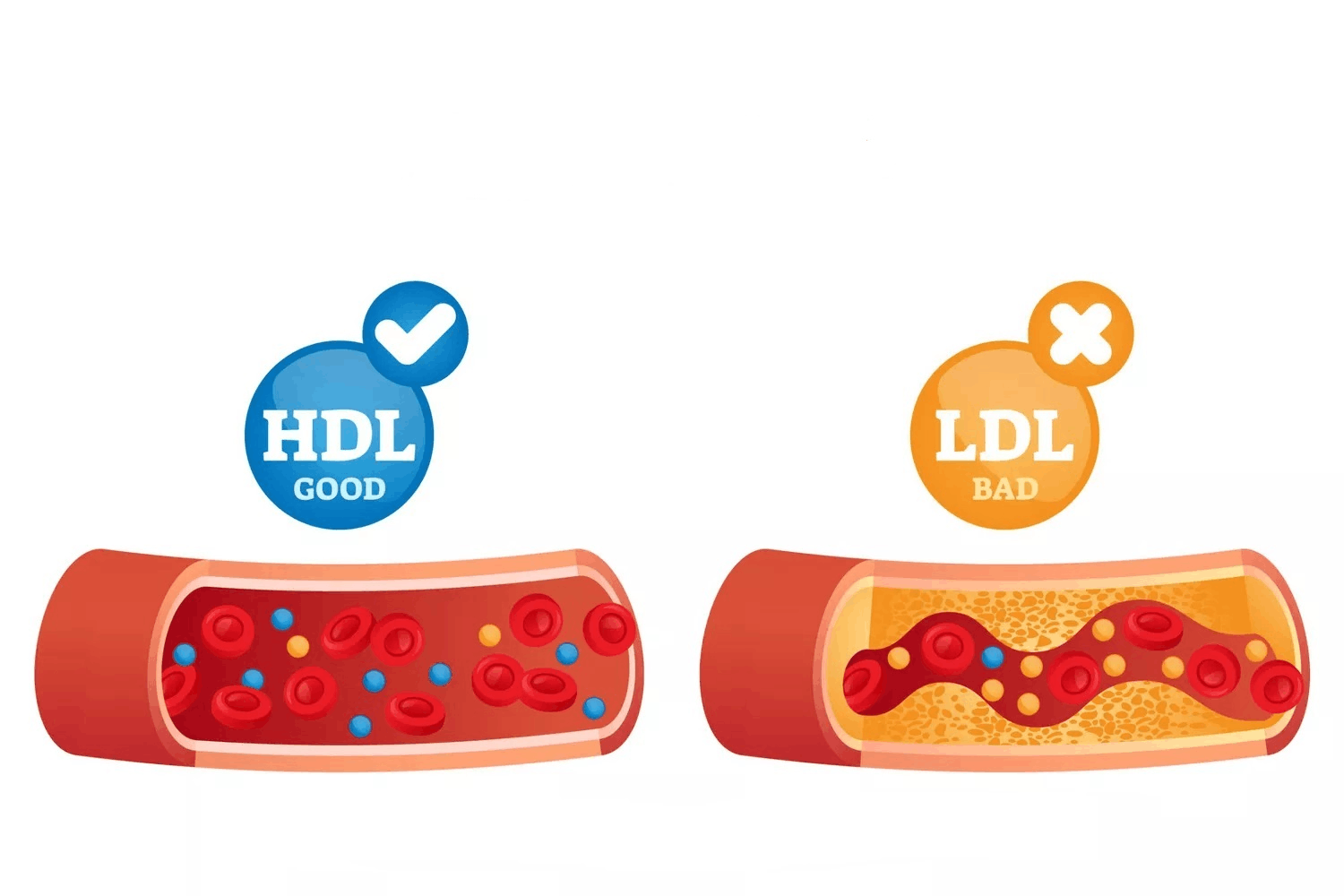 ارتباط کاهش وزن با بهبود HDL
