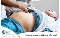 تخلیه آسیت یا آب شکم در منزل