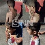 بجنورد/ حمله سگ های ولگرد به یک دانش آموز