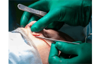 جراحی بینی توسط دستیار دیپلمه و بدون بیهوشی