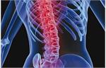 «رماتیسم ستون فقرات» چقدر جدی است؟/تشخیص و درمان یا اعتیاد؟!