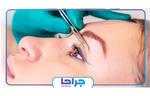 دیگر نگران افتادگی پلک تان نباشید【سال ۱۴۰۲】