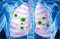 اطمینان کاذب سبب ابتلا به کرونا است