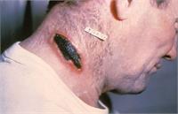 طاعون در تهران؟+عکس و اینفوگرافیک