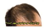 افسانه‌ها و واقعیت‌ها درباره ریزش مو: آنچه باید درمورد Hair Loss and Skin بدانید
