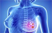 راهکار «مبتلا نشدن» به سرطان پستان؛ مرگبارترین بیماری زنانه!