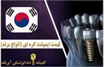 ایمپلنت کره ای مگاژن (قیمت سال ۱۴۰۱)