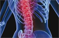 «رماتیسم ستون فقرات» چقدر جدی است؟/تشخیص و درمان یا اعتیاد؟!