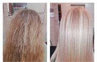 موی کراتینه یا سرطان رحم؟