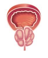 مشکلات پروستات
