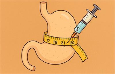 آیا بوتاکس معده می‌تواند پرخوری عصبی را متوقف کند؟ تجربه بیماران واقعی