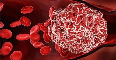 خون قاعدگی: معجزه درمانی آینده یا افسانه بی‌پایه؟