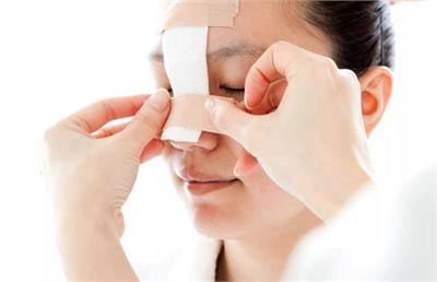 نظرات در مورد عمل بینی بدون تامپون