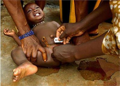 ختنه زنان، یک شوک جهانی: ۲۰۰ میلیون زن قربانی ختنه زنان!