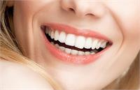 لمینت دندان چه کاربردی دارد؟