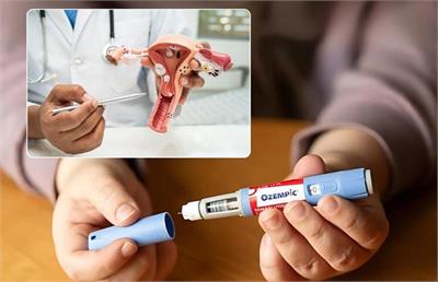 آلت تناسلی اوزمپیکی چیست ؟