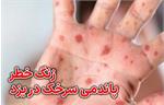شناسایی سه مورد ابتلا به سرخک در یزد