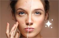 رازهای مهم برای داشتن پوستی صاف و بدون لک