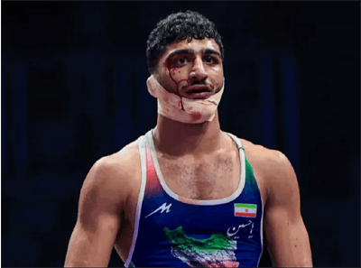 افشاگری دکتر شادگان: حریف فرانسوی عمدا سهرابی را مصدوم کرد!