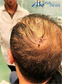 حمله با چاقو به رییس هیات کشتی مازندران در مسابقات مشهد!