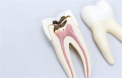 پالپ دندان چیست و چگونه درمان میشود؟