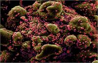 شیوع بیماری ناشناخته و خطرناک در سراسر دنیا/ آماده باش بهداشت جهانی