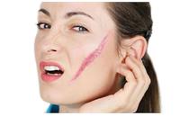 کندی ترمیم زخم در انسان