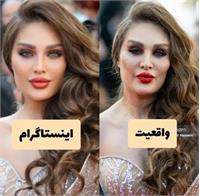 ماجرای تصویر طلا گلزار در فستیوال کن