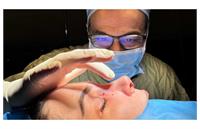 جراحی بینی طبیعی چقدر به فرم صورت من می‌آید؟