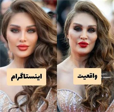 ماجرای تصویر طلا گلزار در فستیوال کن