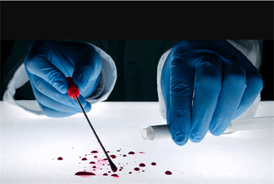 پروسه شناسایی پیکر کشته‌شدگان جنگ؛ از آزمایشگاه تا آزمایش DNA پزشکی قانونی