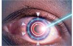 عمل لیزیک؛ بینایی ۱۰/۱۰ در چشم به هم زدنی!