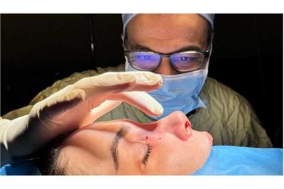 جراحی بینی طبیعی چقدر به فرم صورت من می‌آید؟